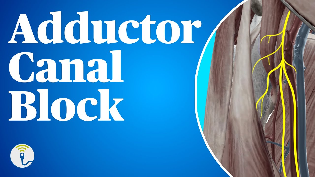 Adductor Canal Block